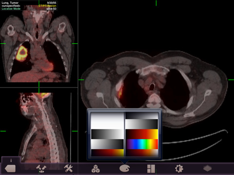 FDA Approves iOS App for Remote Diagnostic Imaging
