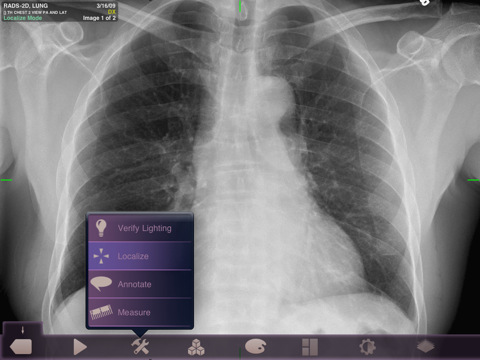 FDA Approves iOS App for Remote Diagnostic Imaging
