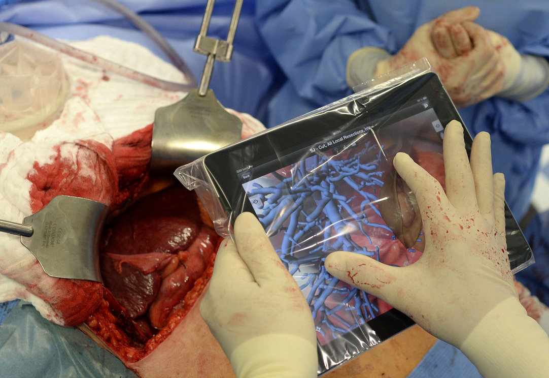 First Liver Surgery Using an iPad in Germany [Photos]