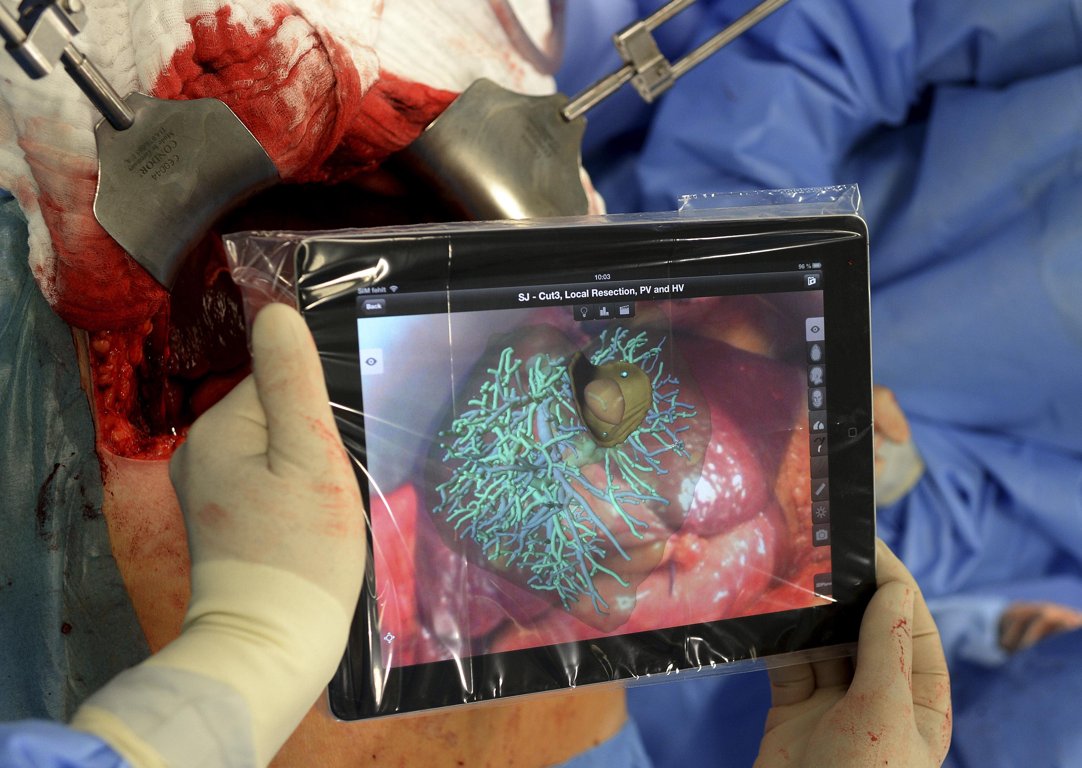 First Liver Surgery Using an iPad in Germany [Photos]