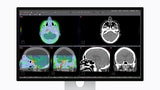 FDA Clearance Enables Studio Display XDR for Diagnostic Radiology