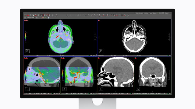 FDA Clearance Enables Studio Display XDR for Diagnostic Radiology