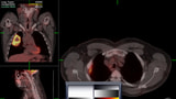 FDA Approves iOS App for Remote Diagnostic Imaging