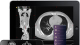 Next Generation Cloud Computing For Medical Images