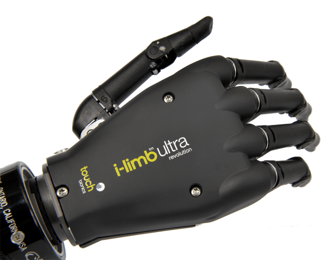 Man Gets Bionic Hands Controlled by the iPhone [Video]