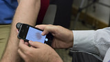 DermoScreen iPhone App Can Detect Skin Cancer