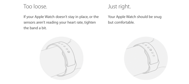 Apple Watch Causes Skin Irritation, Allergic Reactions for Some Users [Photos]