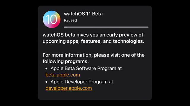 Apple Seeds First Beta of watchOS 11 to Developers [Download] - Vimarsana News